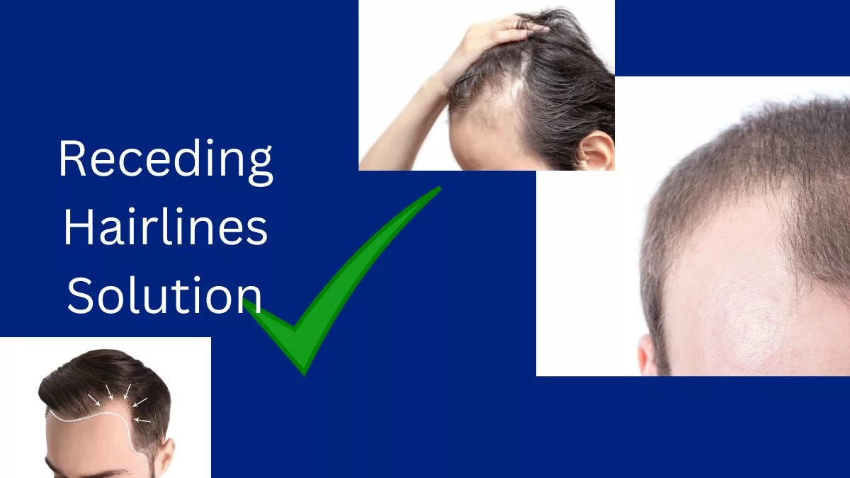 Receding Hairline Solution For Men